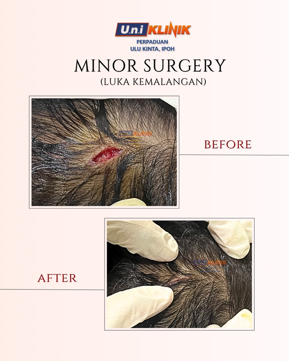 Hasil rawatan Uniklinik Perpaduan