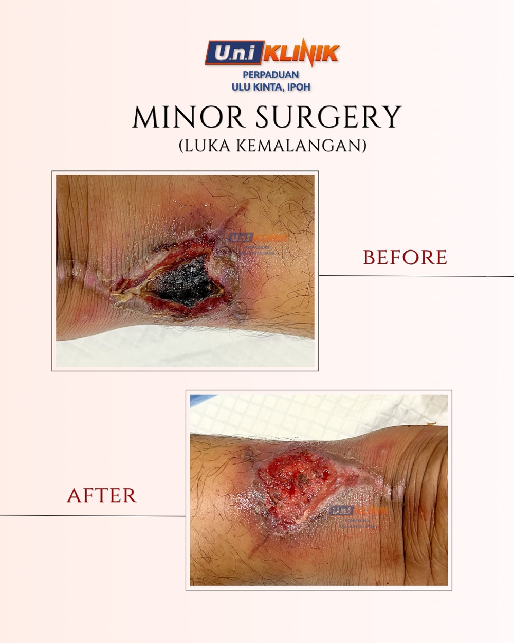 Hasil rawatan Uniklinik Perpaduan